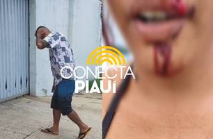 Agressor é preso após acertar pedrada em companheira na zona Rural de Teresina (Foto: Repórter 12/Conecta Piauí) Agressor é preso após acertar pedrada em companheira na zona Rural de Teresina (Foto: Repórter 12/Conecta Piauí)