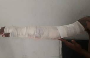 Homem é baleado no braço durante tentativa de homicídio em município no Piauí (Foto: Reprodução) Homem é baleado no braço durante tentativa de homicídio em município no Piauí (Foto: Reprodução)