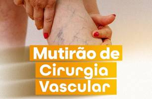 Passagem Franca realiza Mutirão de Cirurgia Vascular para Varizes (Foto: Reprodução/Redes Sociais) Passagem Franca realiza Mutirão de Cirurgia Vascular para Varizes (Foto: Reprodução/Redes Sociais)