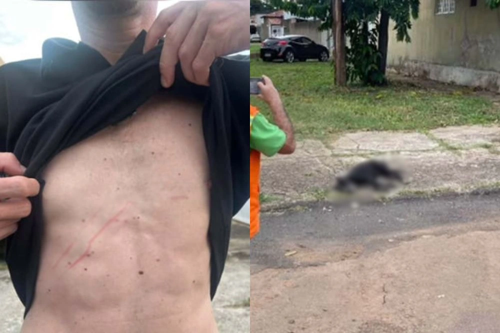Pitbull que estava solto ataca homem na rua e é abatido por policiais em Brasília