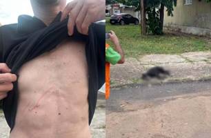 Pitbull que estava solto ataca homem na rua e é abatido por policiais em Brasília (Foto: Reprodução)