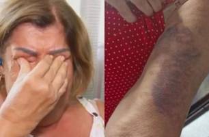 Professora é espancada após cobrar tarefa de casa de um aluno de 7 anos (Foto: Reprodução)