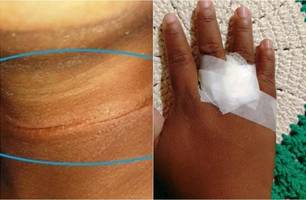 Perigo: criança fica ferida após ser atingida por linha de pipa no Piauí (Foto: Reprodução)