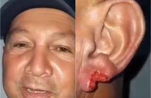 Após beijo, mulher arranca pedaço da orelha de homem durante festa em Piripiri (Foto: Reprodução/ Piripiri Repórter) Após beijo, mulher arranca pedaço da orelha de homem durante festa em Piripiri (Foto: Reprodução/ Piripiri Repórter)