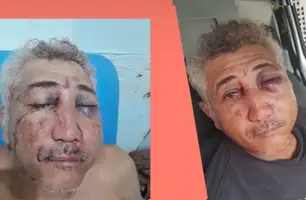 Homem é ferido por motociclista que estava dando 'grau' em Barras (Foto: Reprodução) Homem é ferido por motociclista que estava dando 'grau' em Barras (Foto: Reprodução)