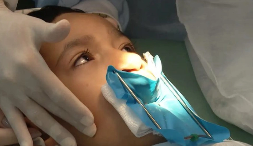 Lula sanciona lei que oferta cirurgia reconstrutiva de lábio leporino no SUS