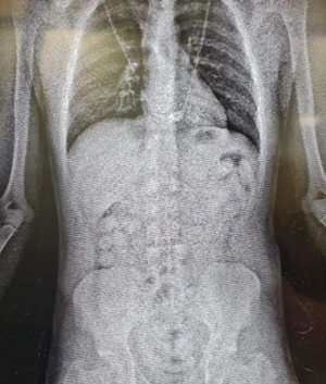 Três pessoas são presas com cocaína no estômago no aeroporto de Fortaleza