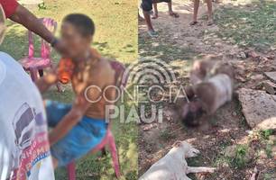 Briga entre amigos termina com os dois esfaqueados em povoado de Nazária (Foto: Repórter 12/Conecta Piauí) Briga entre amigos termina com os dois esfaqueados em povoado de Nazária (Foto: Repórter 12/Conecta Piauí)
