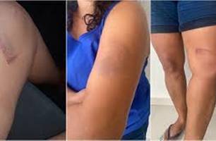 Justiça condena supermercado Mateus por tortura em cliente (Foto: Reprodução)