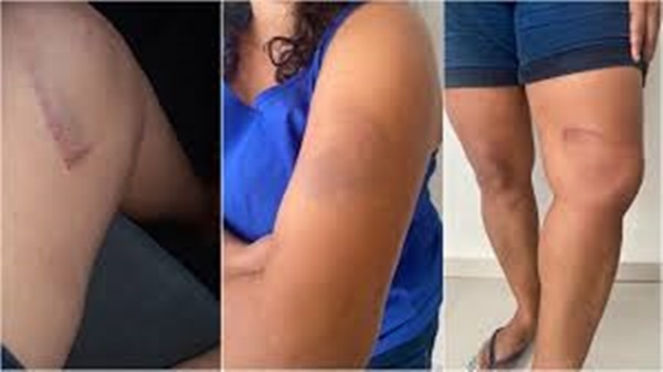 Justiça condena supermercado Mateus por tortura em cliente