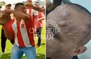 Árbitro é agredido com pedrada após cobrança de pênalti no Maranhão (Foto: Reprodução/Redes Sociais) Árbitro é agredido com pedrada após cobrança de pênalti no Maranhão (Foto: Reprodução/Redes Sociais)
