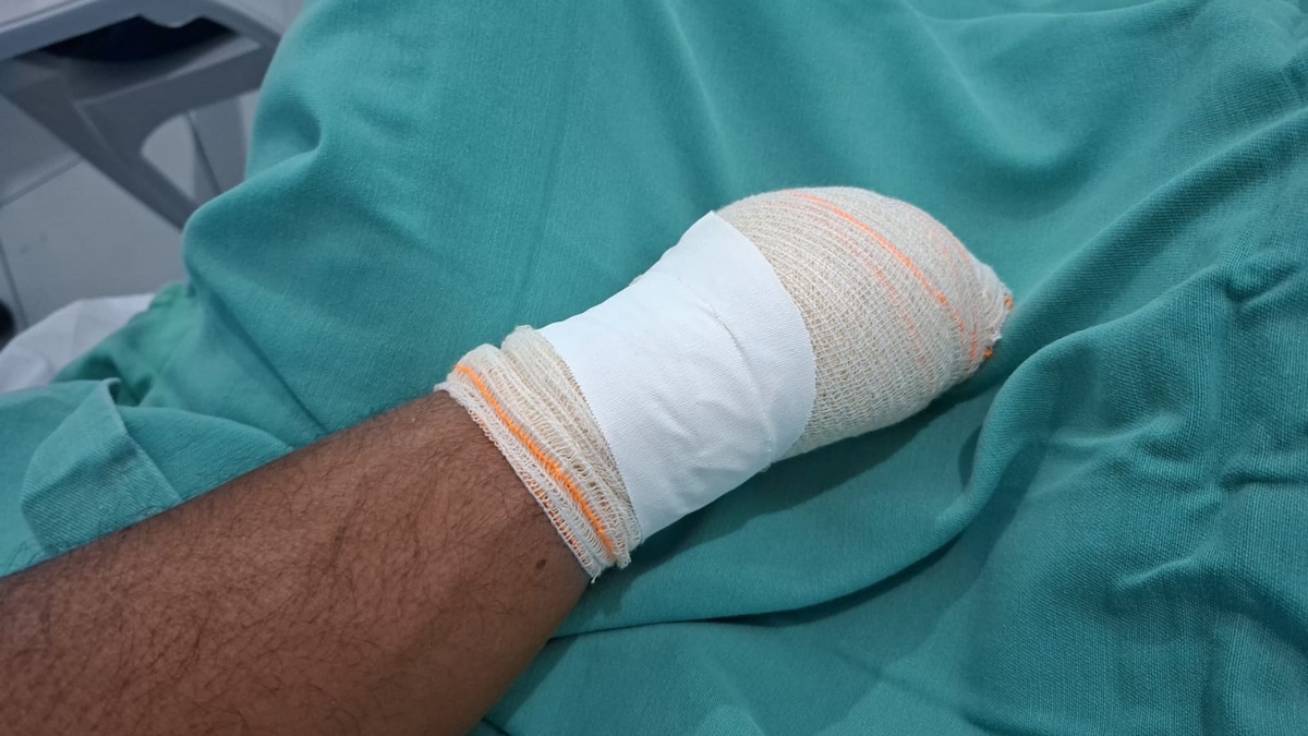 Campo Maior: vizinhos brigam por terreno e mão é decepada por facão