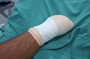 Campo Maior: vizinhos brigam por terreno e mão é decepada por facão (Foto: Reprodução)