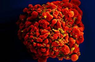 Célula infectada por partículas do vírus HIV, anexas à superfície (Foto: National Institute of Allergy and Infectious Diseases (NIAID)) Célula infectada por partículas do vírus HIV, anexas à superfície (Foto: National Institute of Allergy and Infectious Diseases (NIAID))