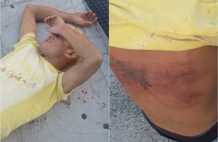 Homem é sequestrado, espancado e abandonado em via pública em Parnaíba (Foto: Reprodução) Homem é sequestrado, espancado e abandonado em via pública em Parnaíba (Foto: Reprodução)