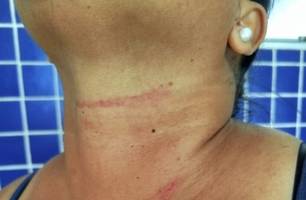 Mulher foge de agressor e aciona PM em Monte Alegre (Foto: Reprodução/PM/Portal Gurguéia) Mulher foge de agressor e aciona PM em Monte Alegre (Foto: Reprodução/PM/Portal Gurguéia)
