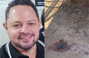 Policial ferido em operação que matou delegado passa por cirurgia em Teresina (Foto: Reprodução)