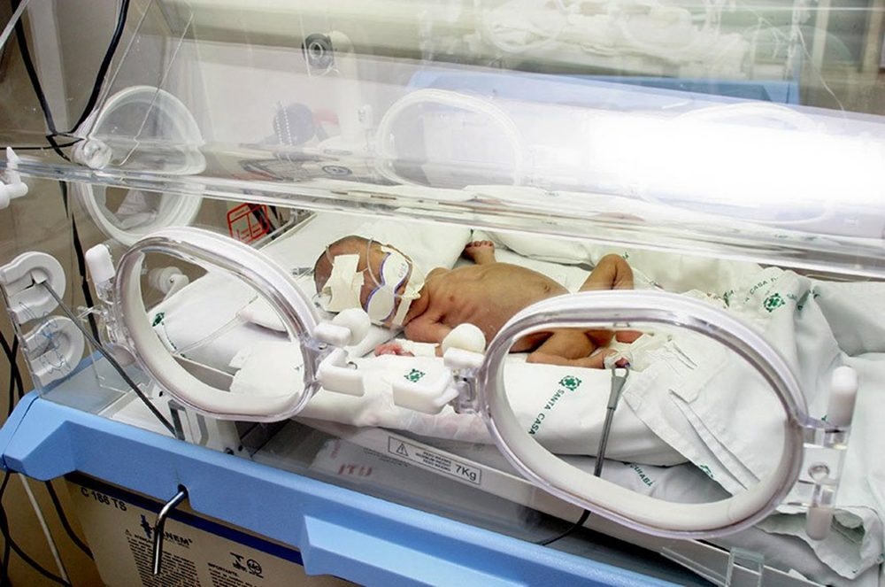 Projeto propõe equidade na imunização de recém-nascidos prematuros pelo SUS