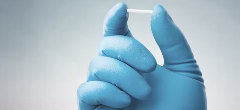 SUS vai oferecer novo implante contraceptivo de longa duração e alta eficácia