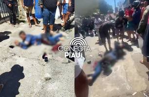 Tiro que acertou criminoso em arrastão no Dirceu quebrou perna do menor de idade (Foto: Reprodução) Tiro que acertou criminoso em arrastão no Dirceu quebrou perna do menor de idade (Foto: Reprodução)