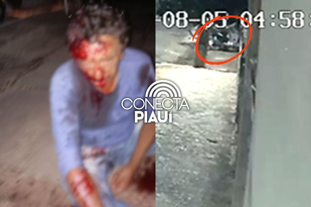 Homem é brutalmente apedrejado durante tentativa de assalto em Piracuruca