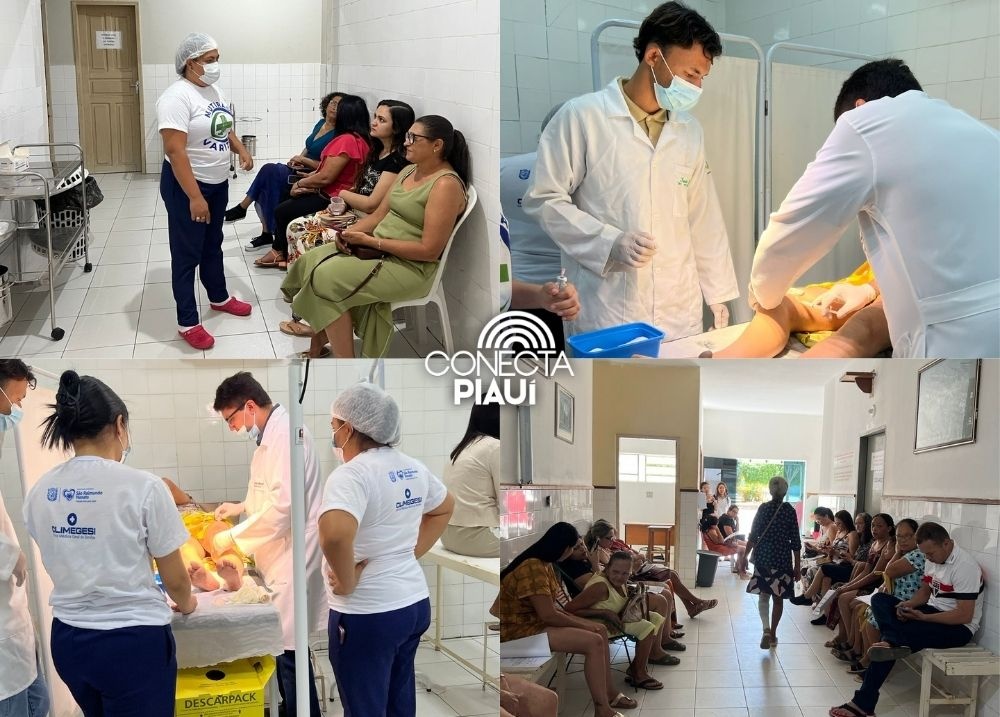 Mutirão de varizes garante atendimento gratuito em São Raimundo Nonato