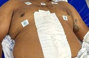 Saiba como está o segurança baleado em Timon próximo ao Banco do Brasil (Foto: Reprodução) Saiba como está o segurança baleado em Timon próximo ao Banco do Brasil (Foto: Reprodução)