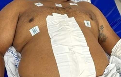 Saiba como está o segurança baleado em Timon próximo ao Banco do Brasil