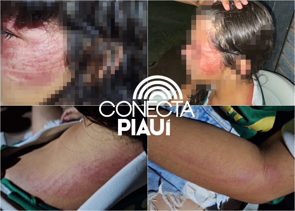 Menina de 12 anos é resgatada após denúncia de maus-tratos em Miguel Alves