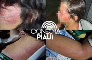 Menina de 12 anos é resgatada após denúncia de maus-tratos em Miguel Alves (Foto: Reprodução) Menina de 12 anos é resgatada após denúncia de maus-tratos em Miguel Alves (Foto: Reprodução)