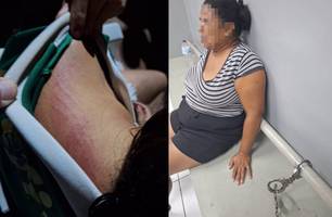 Menina de 12 anos é resgatada com sinais de agressão em Miguel Alves; mãe é presa (Foto: Reprodução) Menina de 12 anos é resgatada com sinais de agressão em Miguel Alves; mãe é presa (Foto: Reprodução)